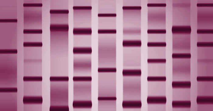 A close-up view of a DNA gel electrophoresis showing several bands of varying lengths, appearing as horizontal bars in shades of purple against a lighter purple background.